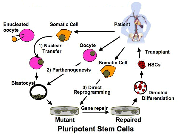 Figure: Treatment of genetic bone marrow disease...